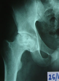 рентген-до-операции