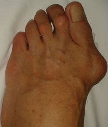 третий палец на правой ноге что означает